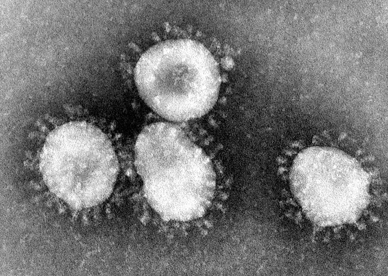 Coronavirus: Exports Expected to Slow